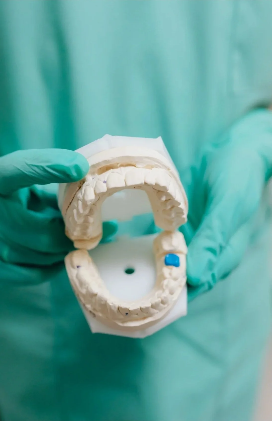 Dental model of upper and lower teeth held by gloved hand in dental office.