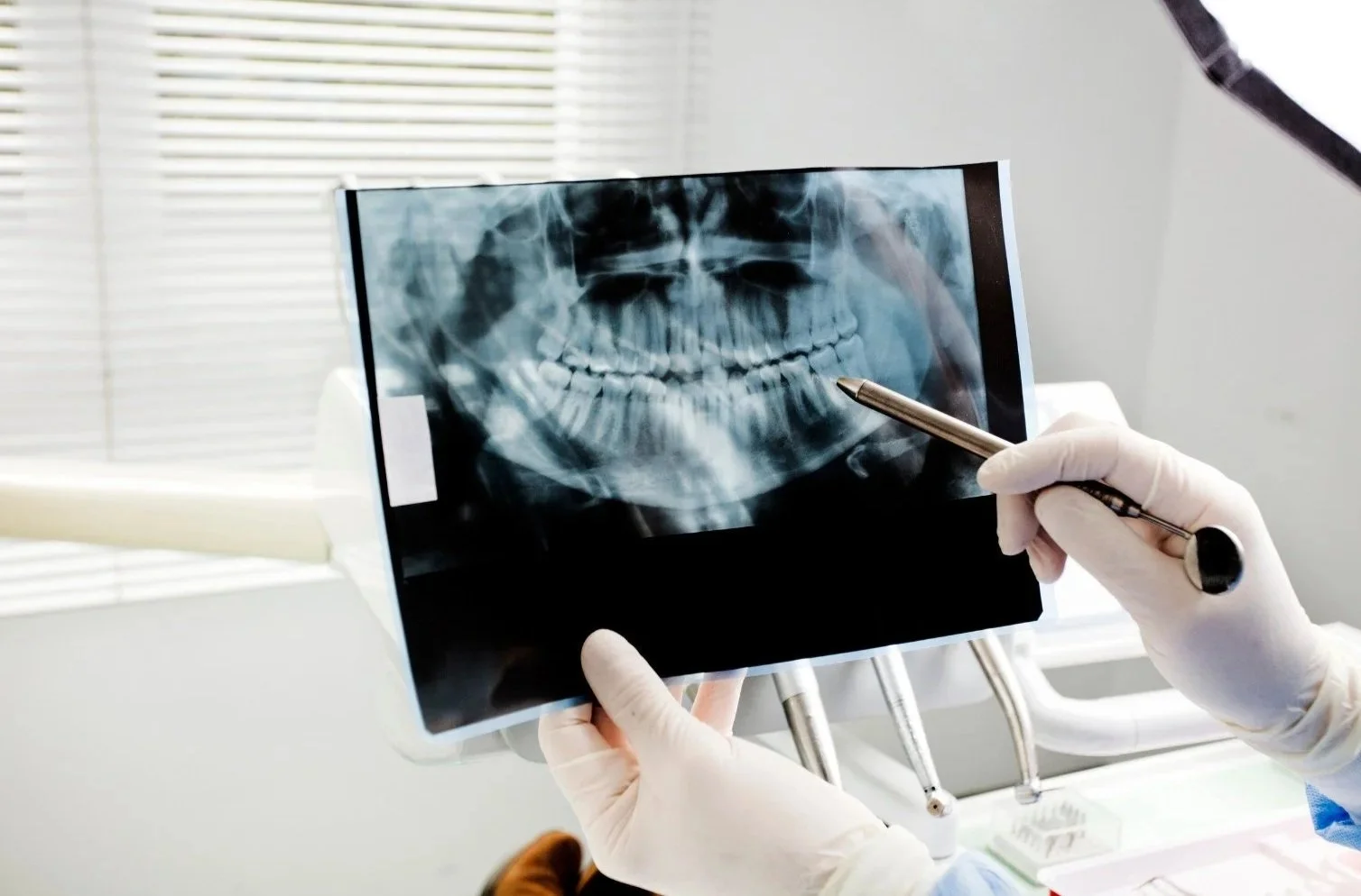 A medical professional holding a dental X-ray of a patient's teeth. The person is wearing gloves and pointing at the X-ray with a pen. The background shows a clinic setting with blinds on a window.
