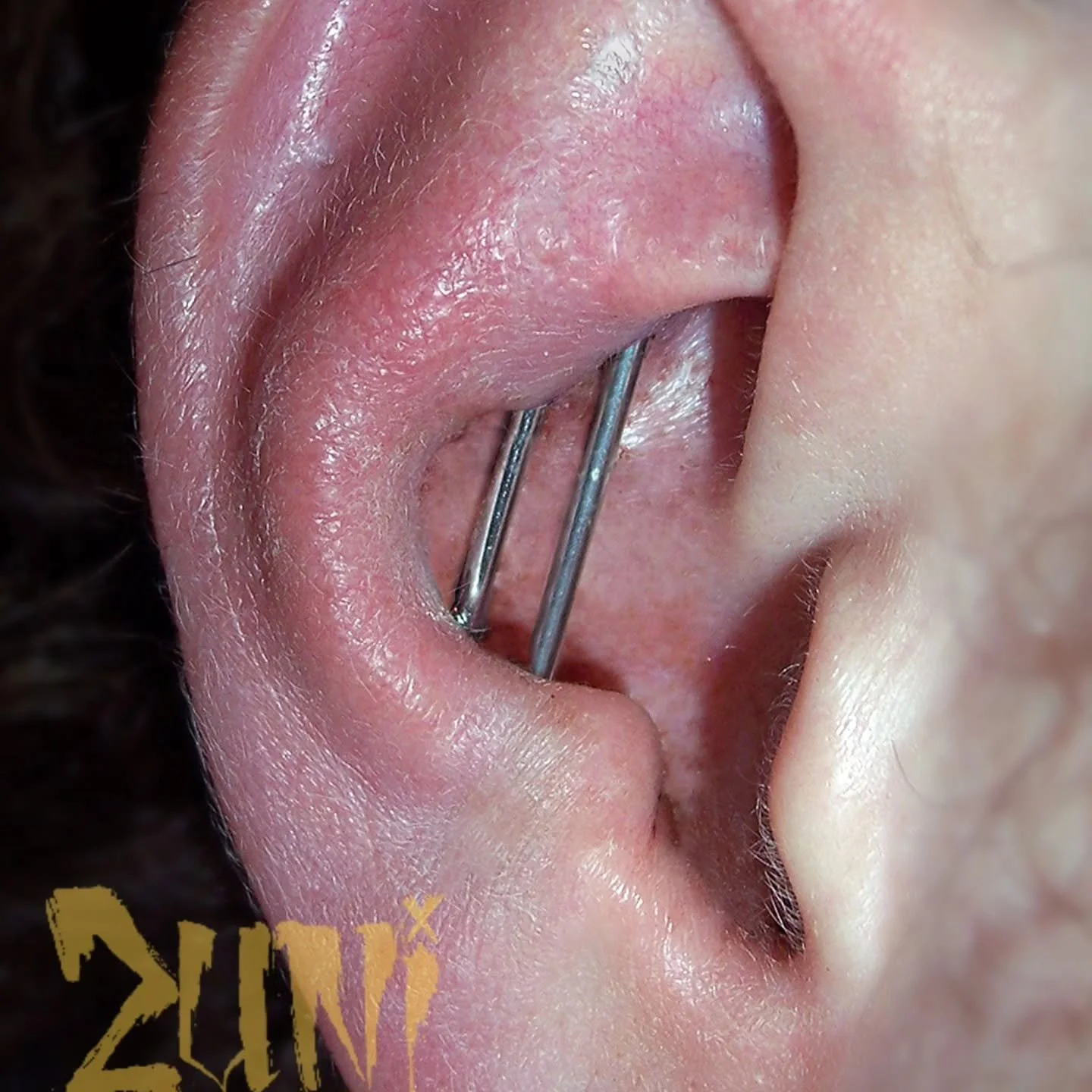 Double Conch Industrial that turned out amazingly. Check out my other work and come get pierced. Show your local piercer some love.

#artifexlongmont #bodypiercing #earpiercing #industrialpiercing #custombodyjewelry