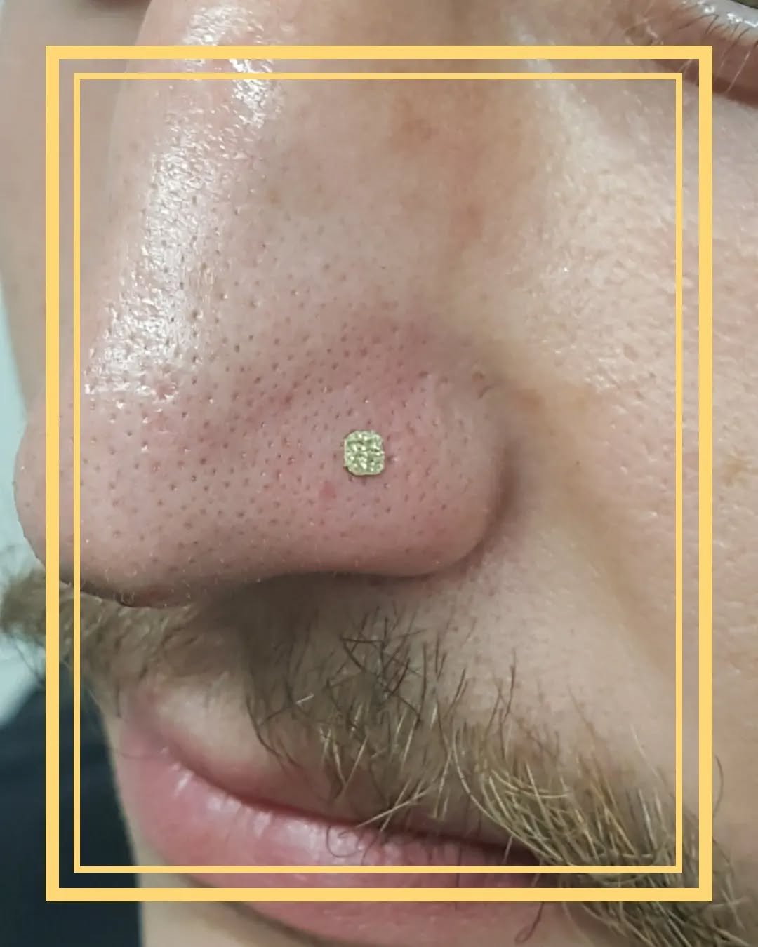 Nose Piercing with yellow gold hammered disk.
@thezunster
♡
ArtifexLongmont.com
Facebook.com/Artifexbodymod
♡
Instagram/Facebook - @TheZunster
Website - http://TheZunster.com
YouTube - @ritualfleshsuspensionteam
♡
#thezunster #bodypiercing #bodypierc