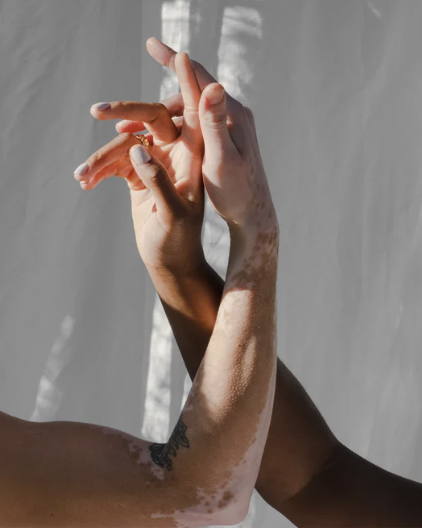 Two hands with different skin tones intertwined against a light background.