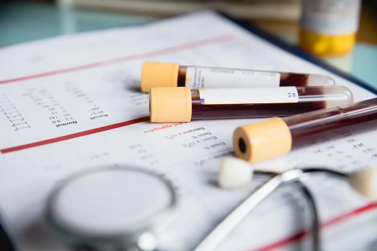 Several blood sample test tubes with yellow caps resting on a medical report or chart, along with a stethoscope in the foreground.
