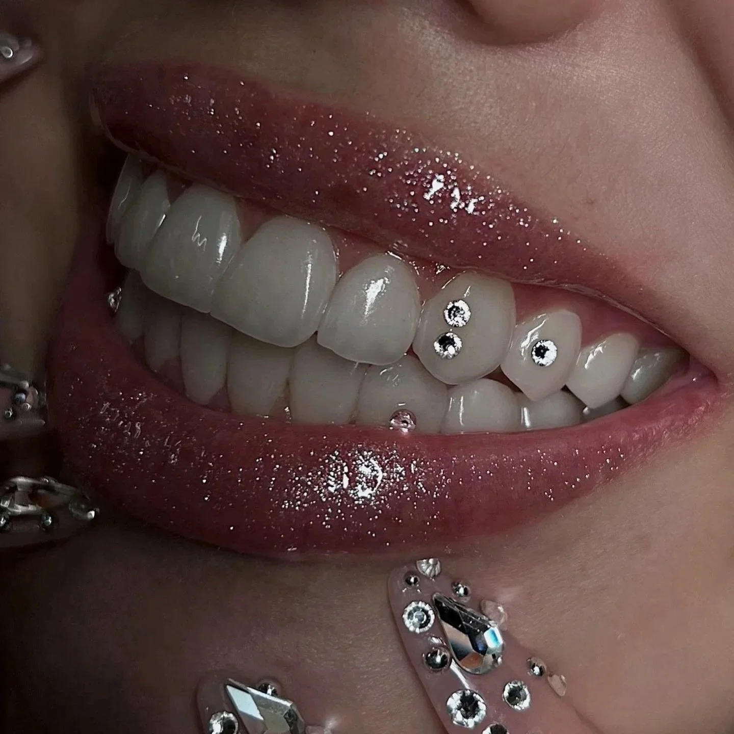Nahaufnahme eines lachenden Mundes mit weißen Zähnen, rosa Lippen mit Glitzer, und Piercings sowie Strasssteinen auf der Lippe.