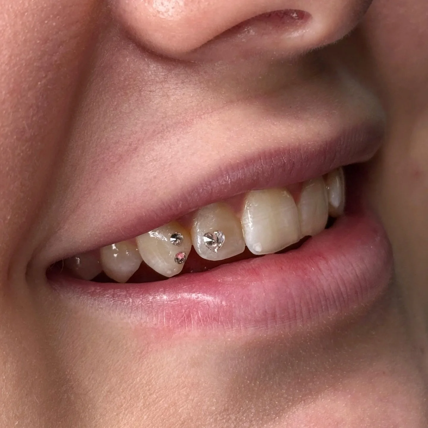Naheaufnahme eines lachenden Mundes mit sichtbaren Zähnen, von denen einige mit kleinen, klaren Kristallen verziert sind.