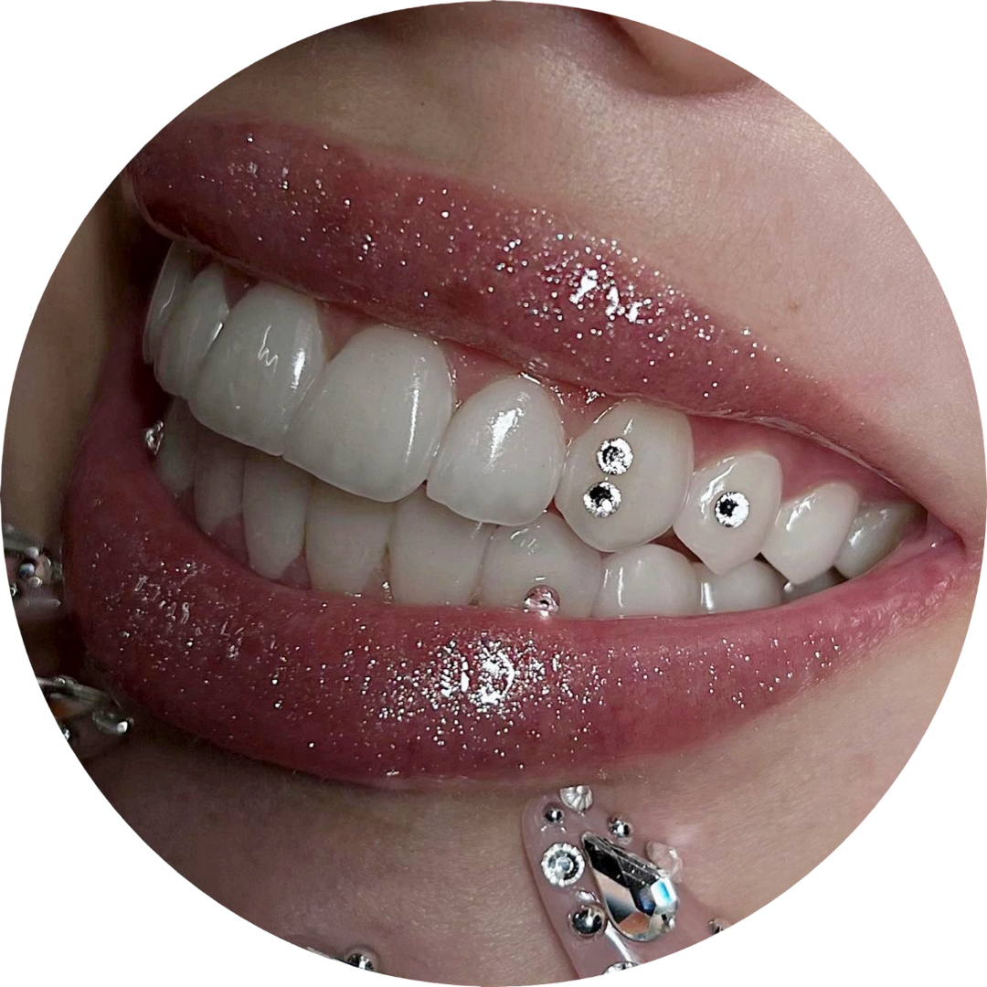Tooth Gems, Zahnschmuck, Tooth Gemzh, Lines Ink Tattoo, Zürich