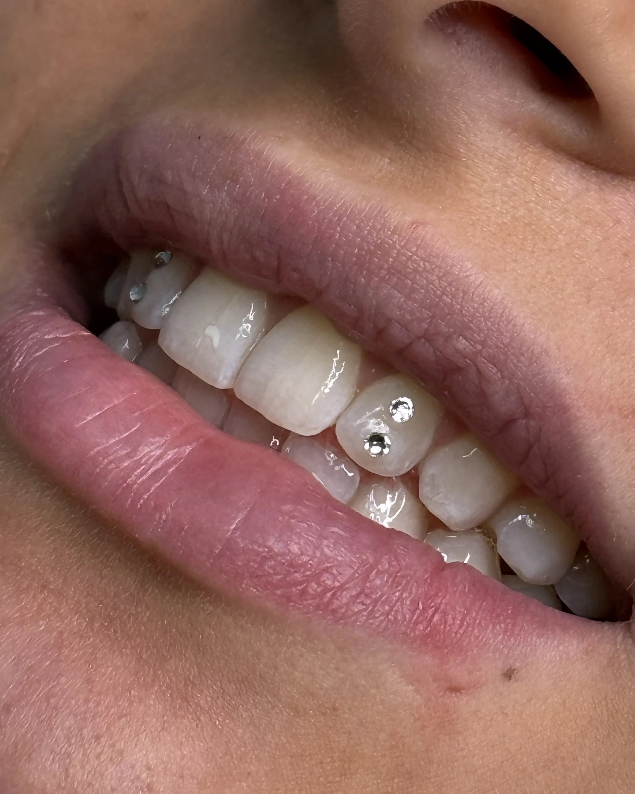 Nahaufnahme eines lachenden Mundes mit weißen Zähnen, die mit kleinen Glitzersteinen verziert sind, und pinken Lippen