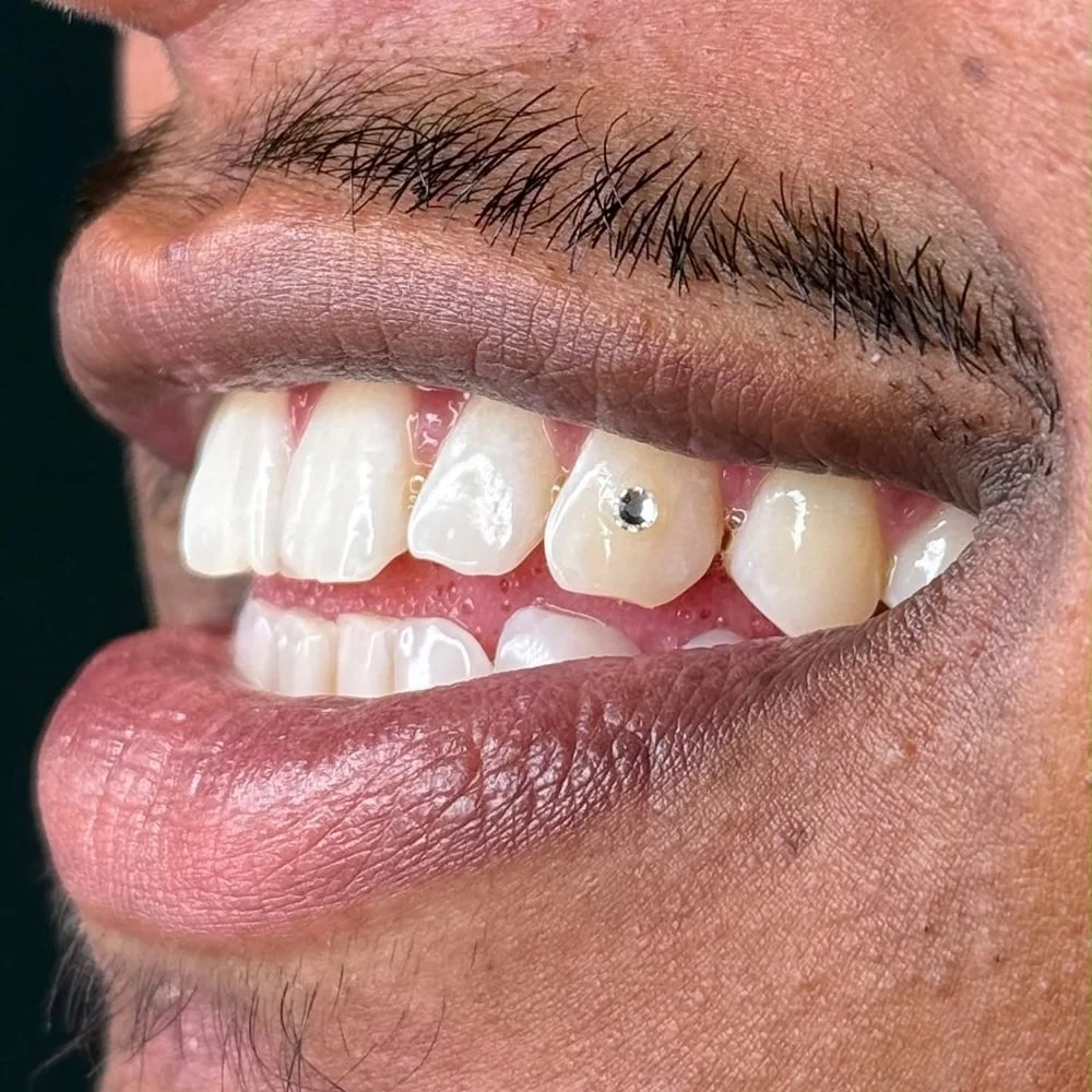 Nahaufnahme eines lachenden Mundes mit Zähnen, die mit Piercings und kleinen Schmuckstücken verziert sind, und einer Person mit einer Nagelfeile, auf der ein rotes Herz gemalt ist.