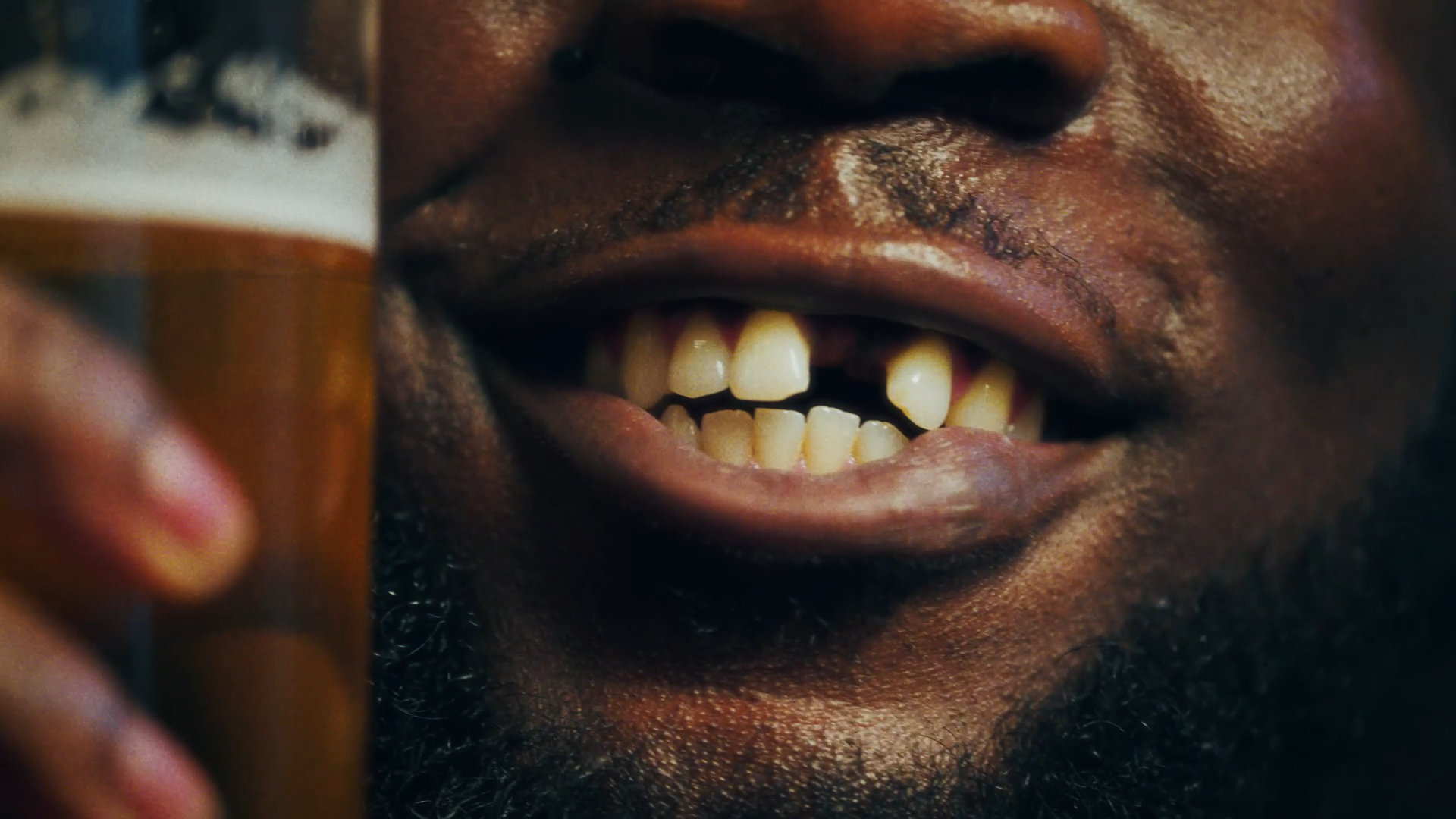 Close-up of a man with missing front teeth holding a beer bottle near his mouth.