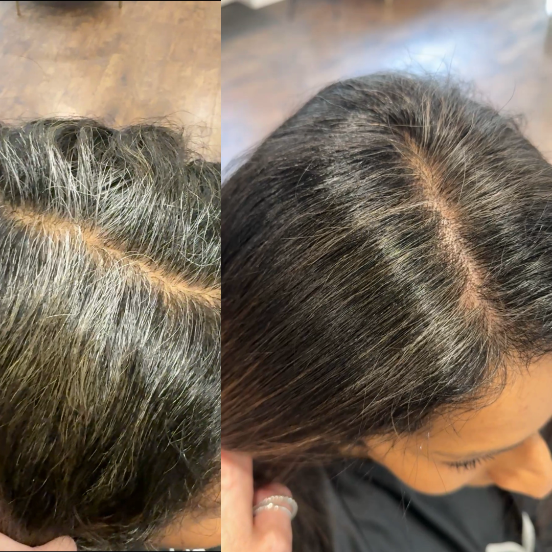 Comparison of a woman's scalp showing gray and dark hair before and after hair treatment showing darker, more even hair color.