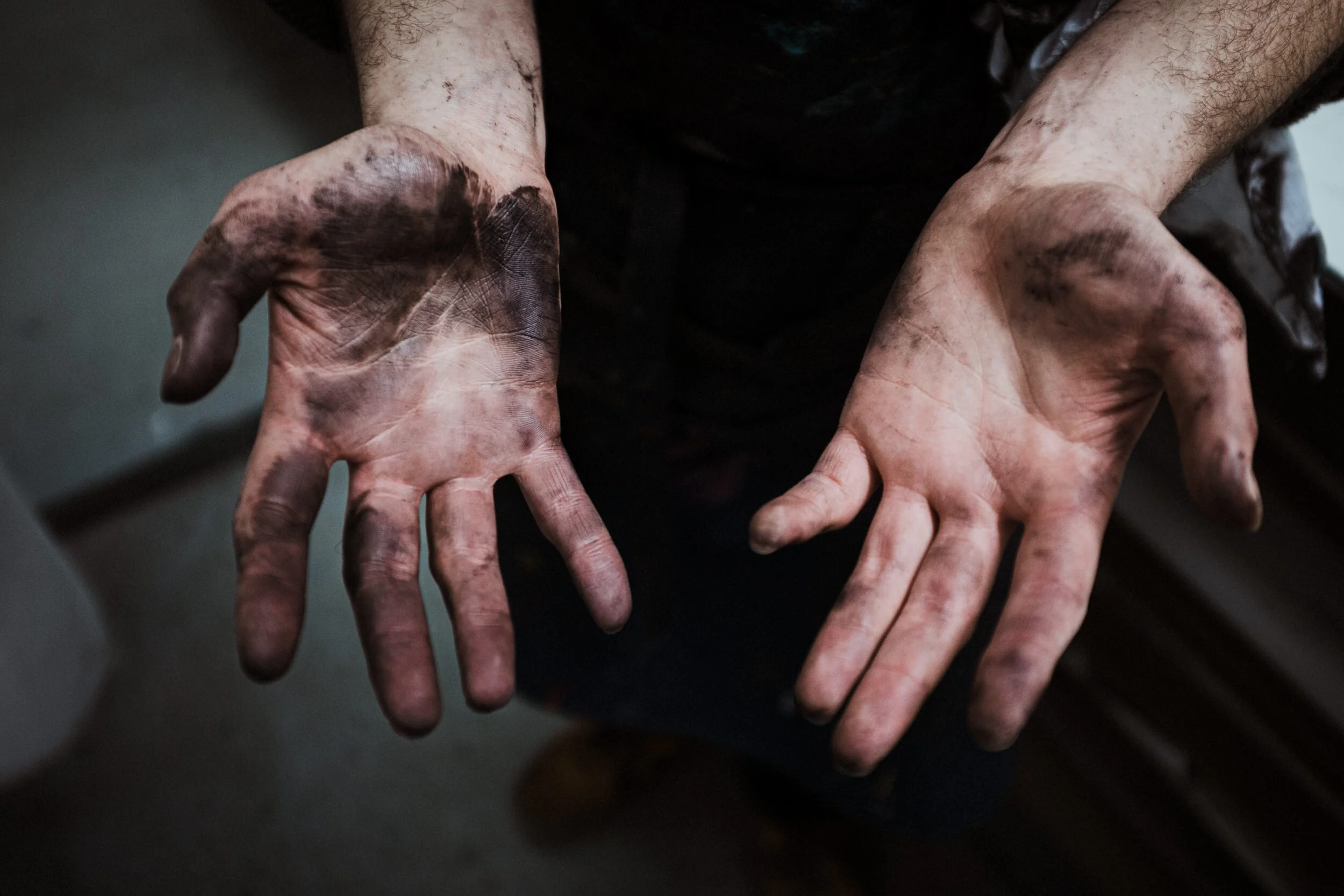 Dirty, muddy hands with visible dirt and grime.