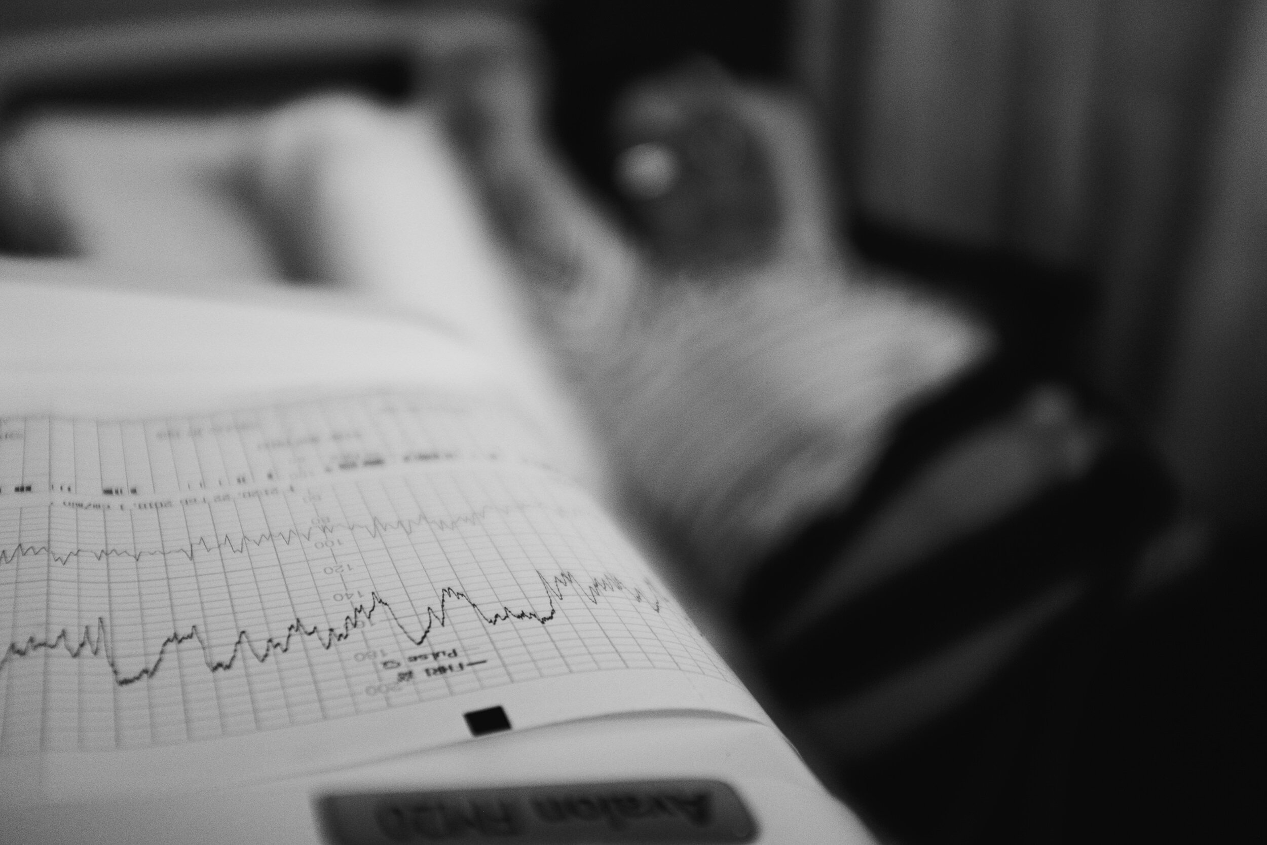 Close-up of a printed page with line graphs showing data trends, resting on a notebook or table, with a blurred background.