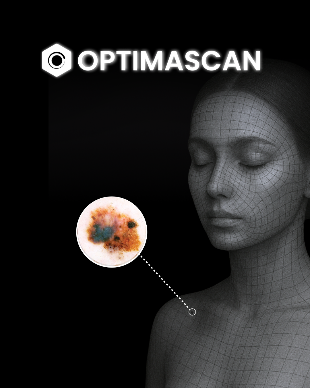 What is Mole Mapping?