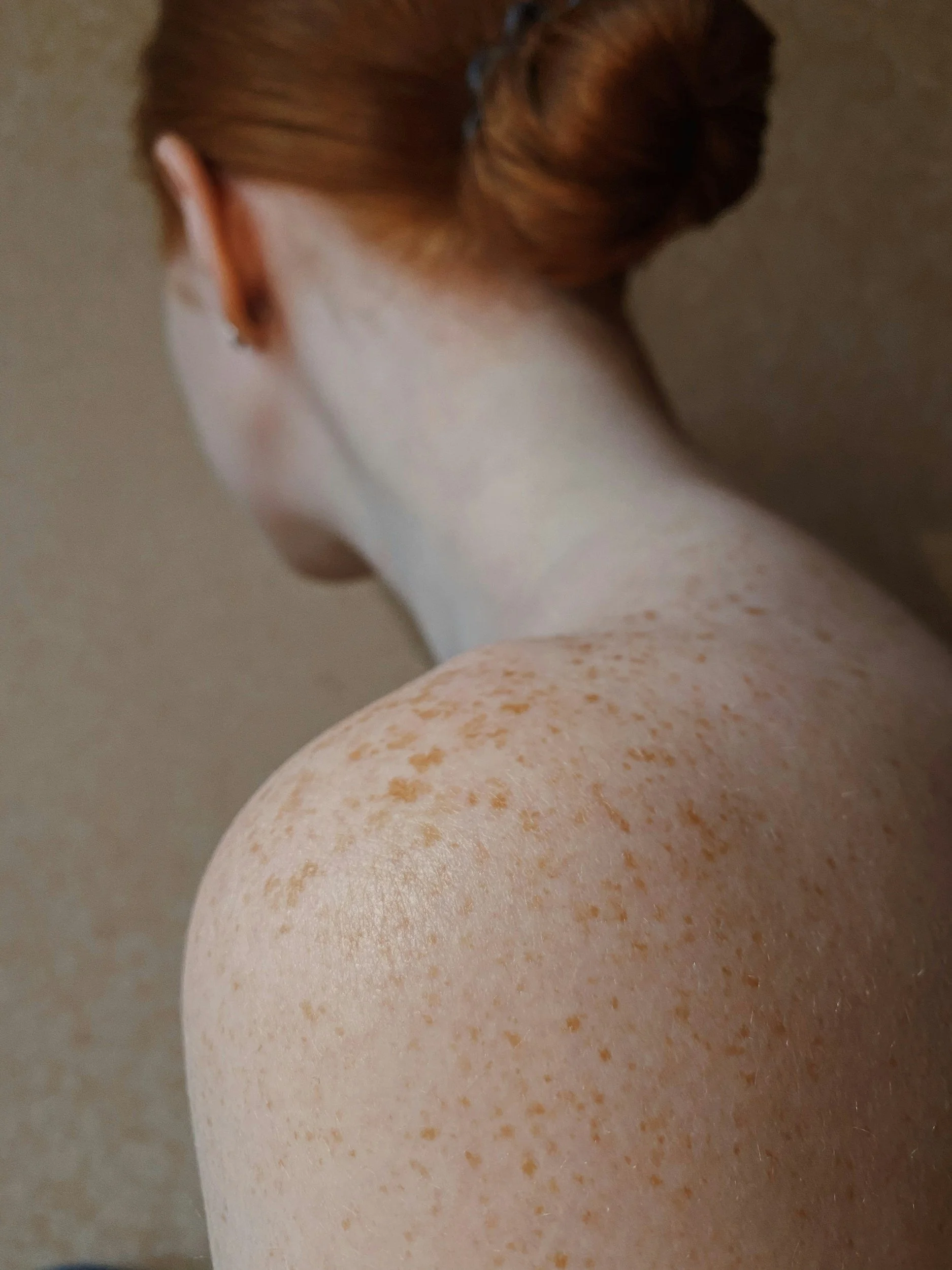 Are You at Risk for Skin Cancer?