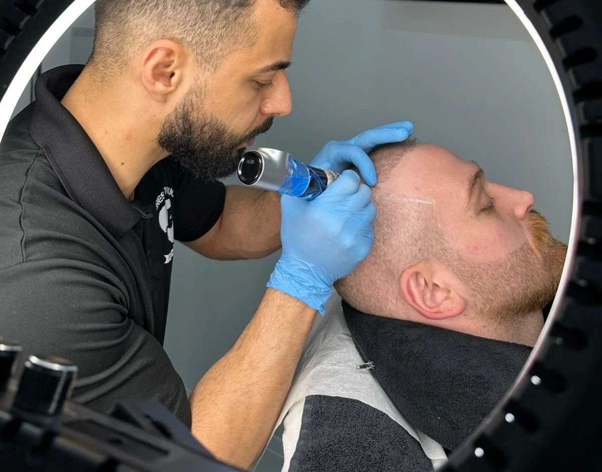 A man receiving a tattoo on the side of his head using a tattoo machine, with an artist wearing blue gloves