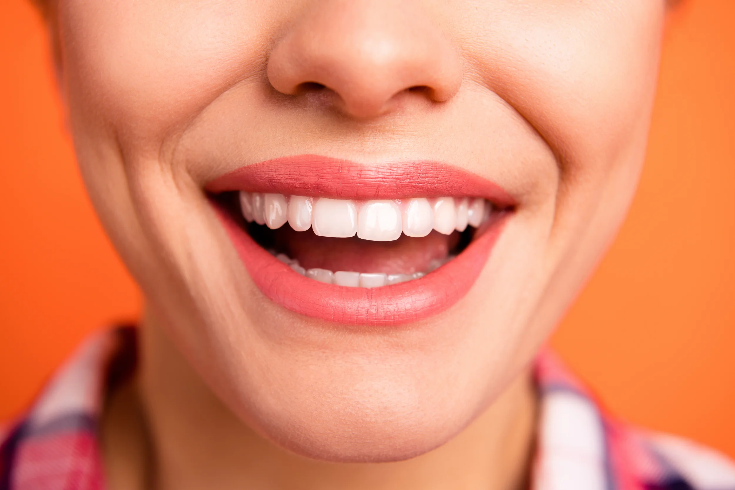All on Four Fixed Bridge Dental Implant Procedure Result Izmir