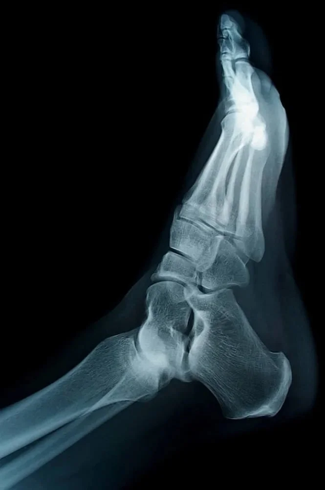 best foot fracture podiatrist nyc near me
