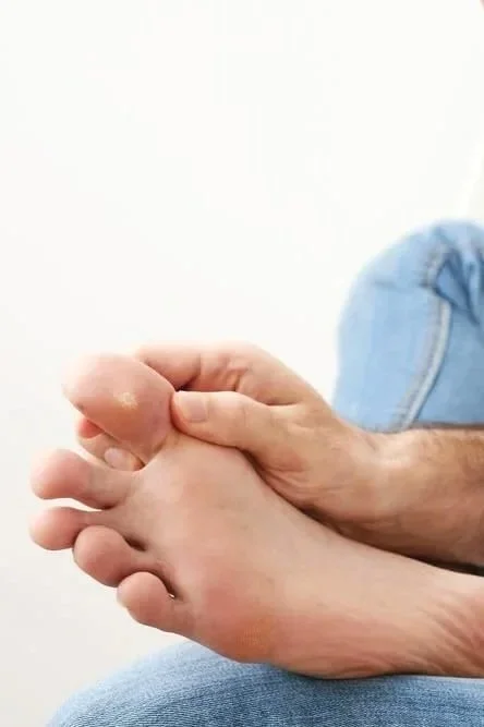 wart removal midtown and downtown manhattan podiatrist