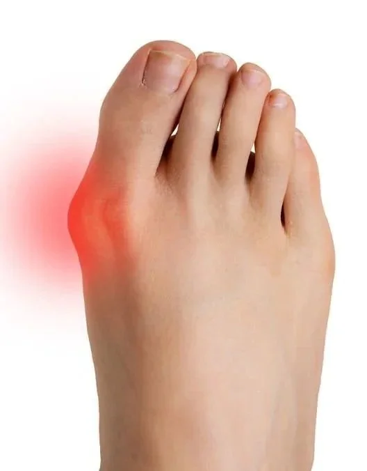 best bunion doctor and surgeon nyc