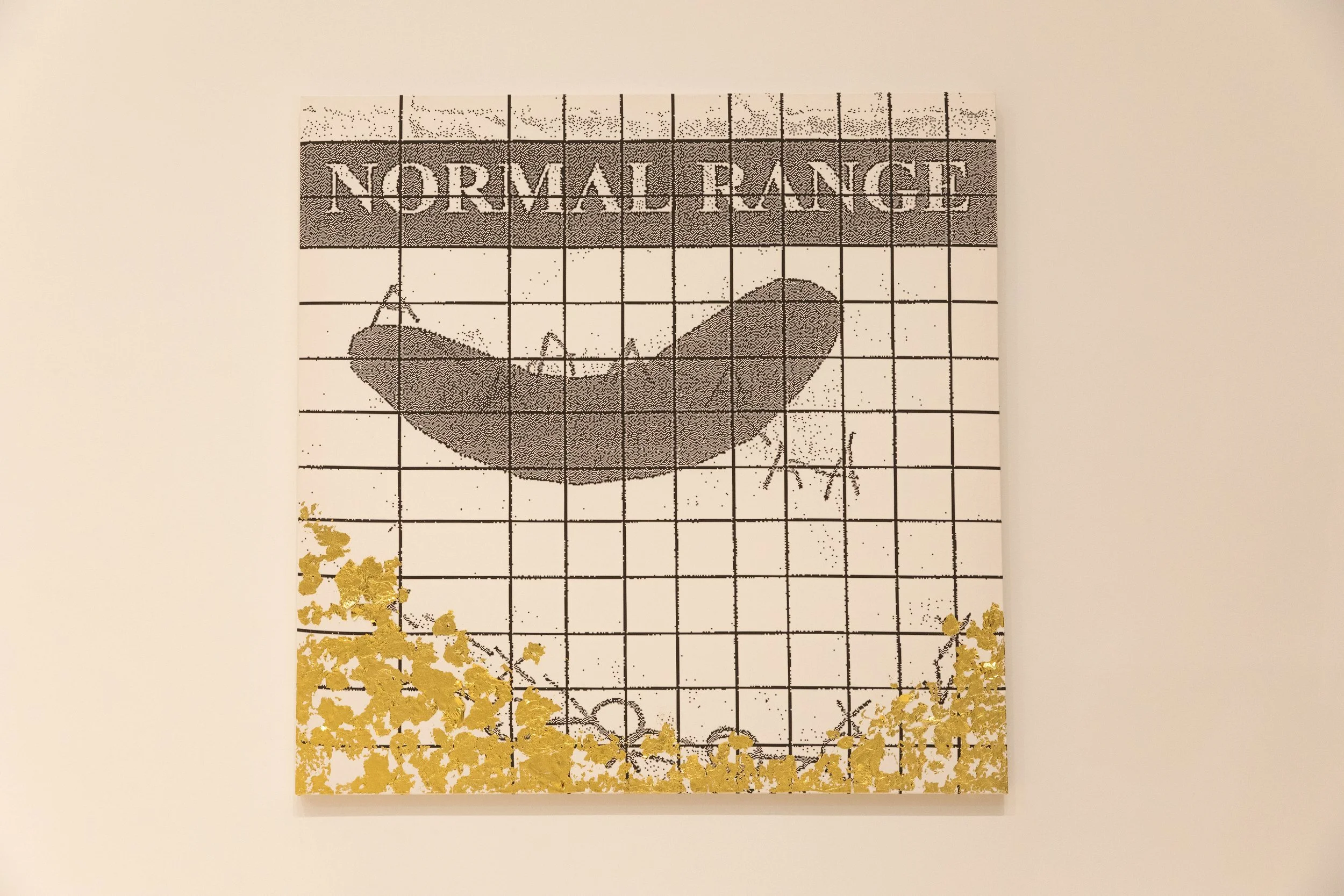 Probable Normal Hearing