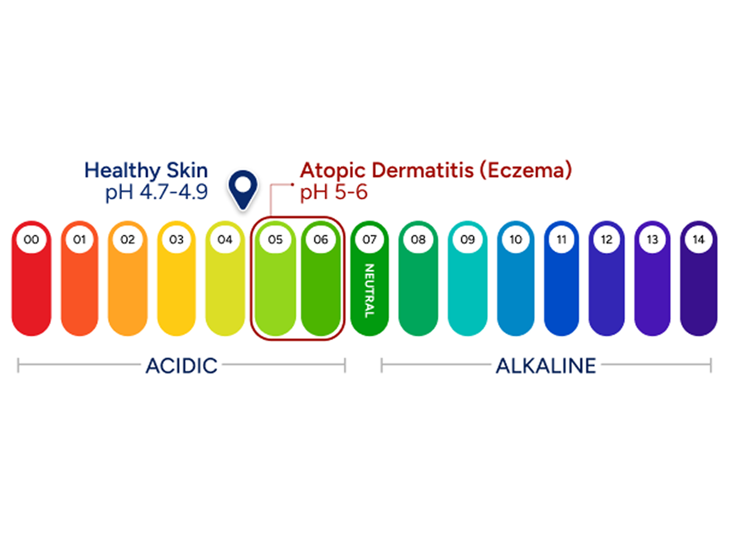 The pH Problem at the Heart of Eczema