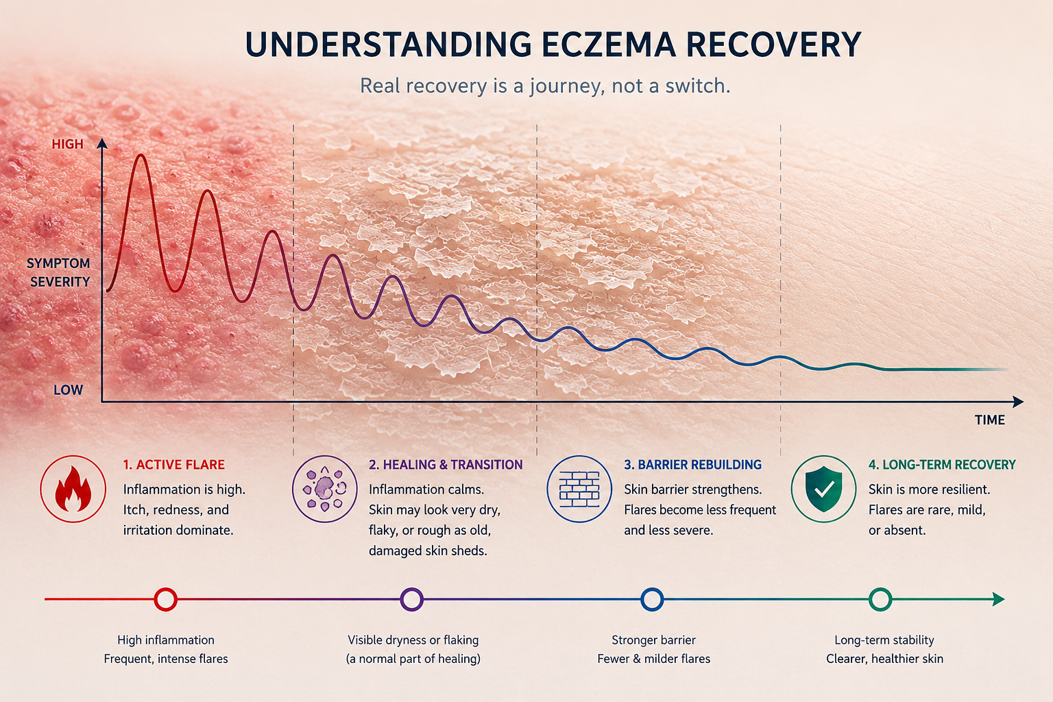 Your Eczema Treatment Is Working Even If It Doesn't Look Like It