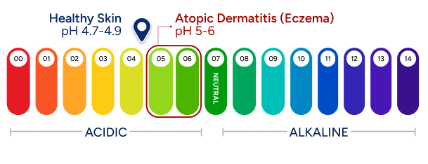 pH scale with acidic and alkaline range, healthy skin of pH 4.7-4.9 and atopic dermatitis (eczema) highlighted as pH 5-6