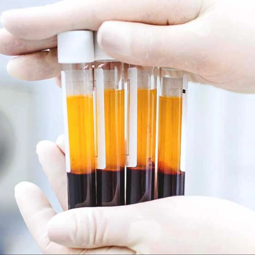 prp-1.jpg