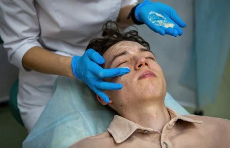 KAWSAY RESTAURACIÓN ACNÉ