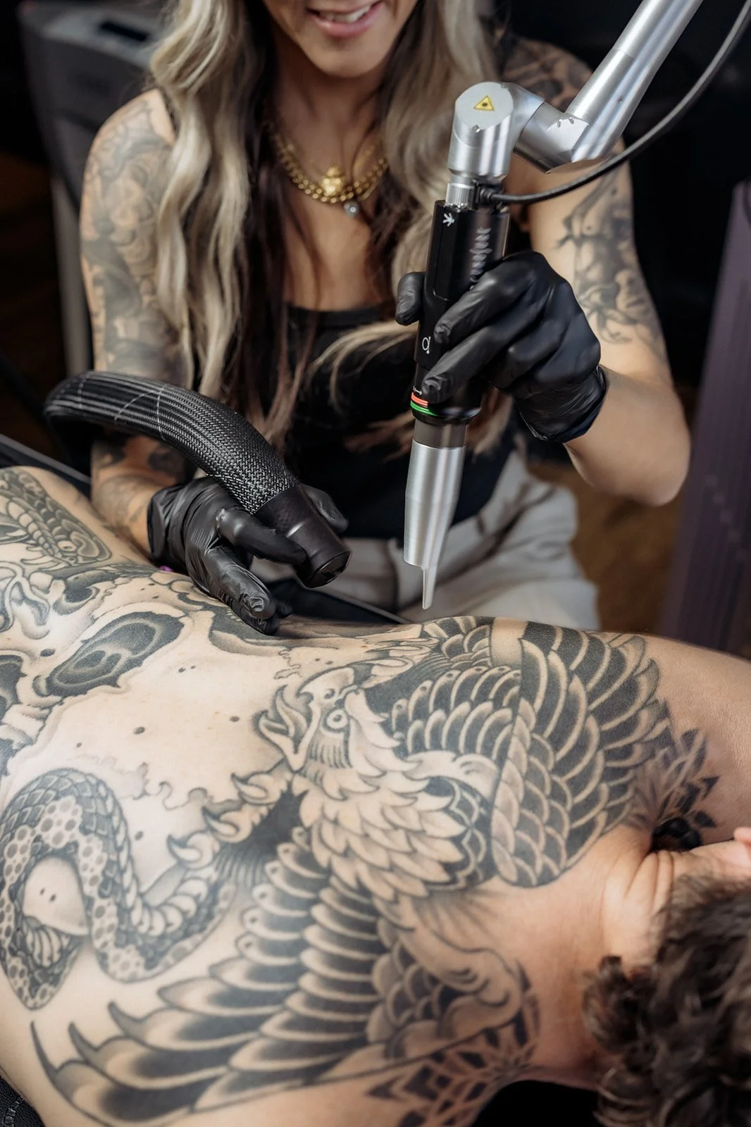 Tattoo removal procedure in progress on a man’s back, with a technician using a laser device and suction tool over large skull and snake tattoos while wearing protective gloves