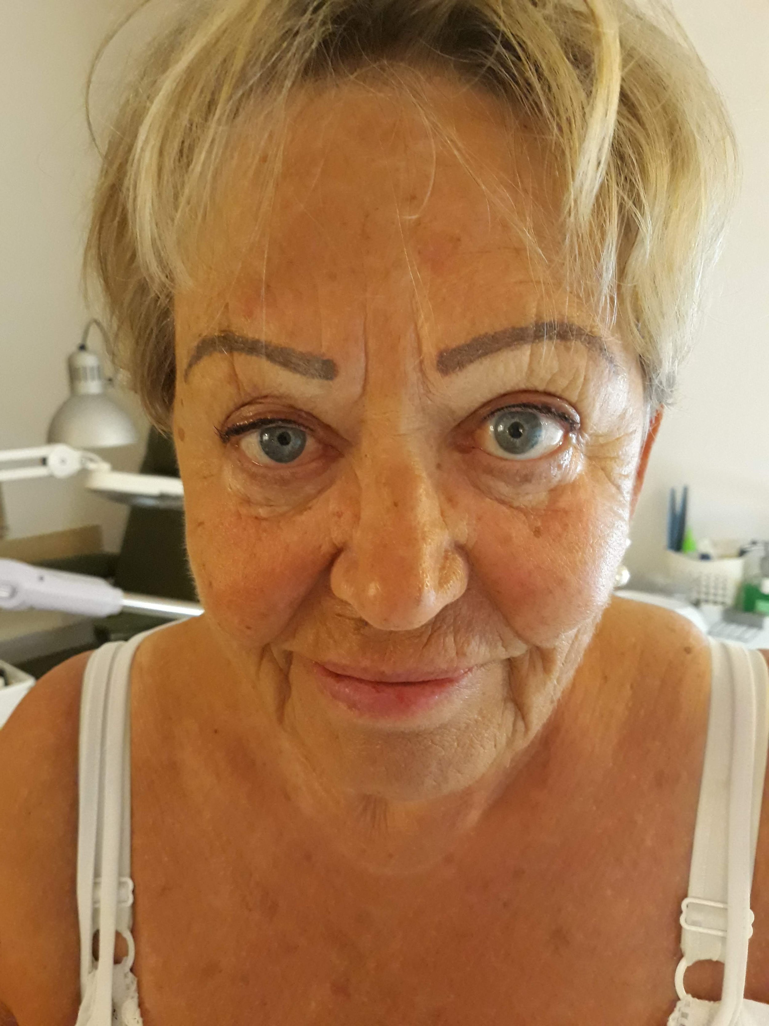 Before After-3.jpg