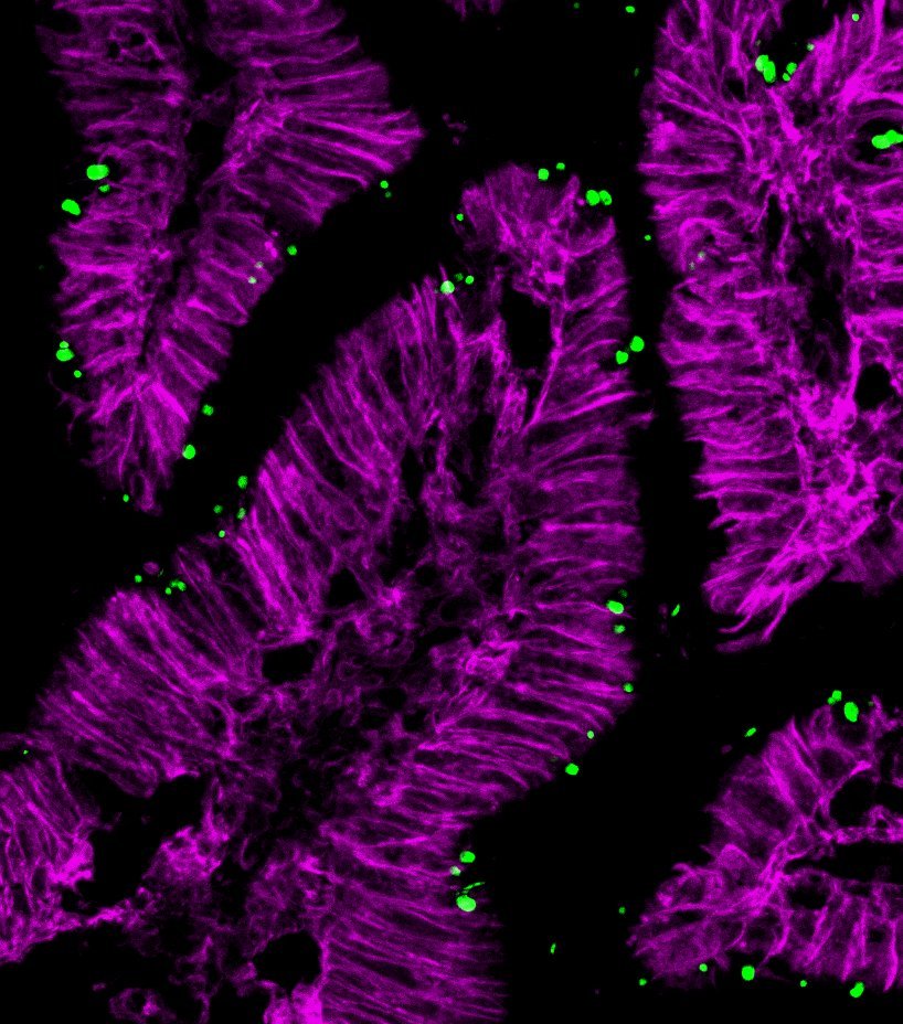 In vivo ileum infected with Cryptosporidium labeled in green and host EpCAM in magenta.