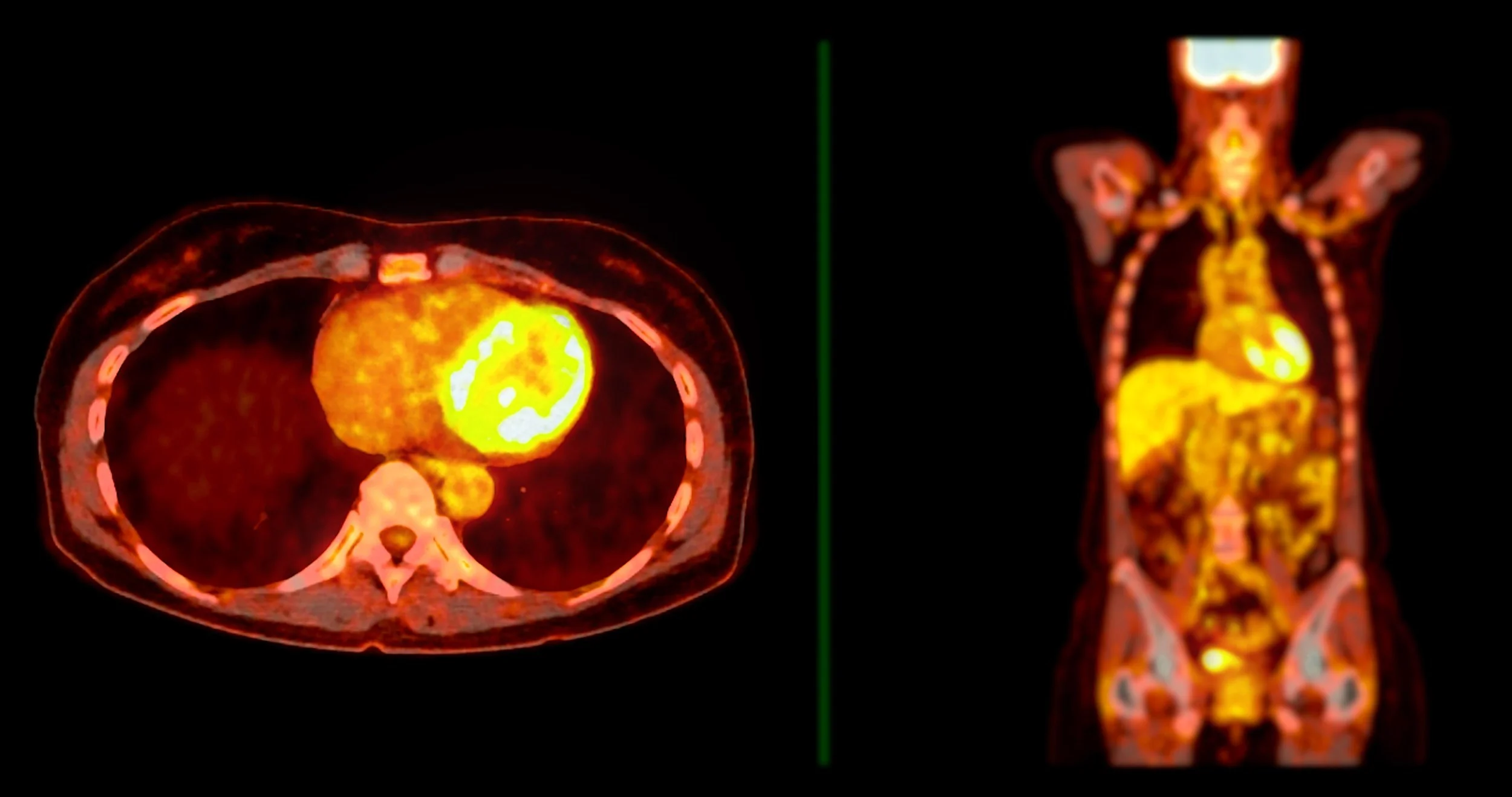 Medical imaging scans showing cross-sectional and full-body views of a human body with highlighted internal organs.