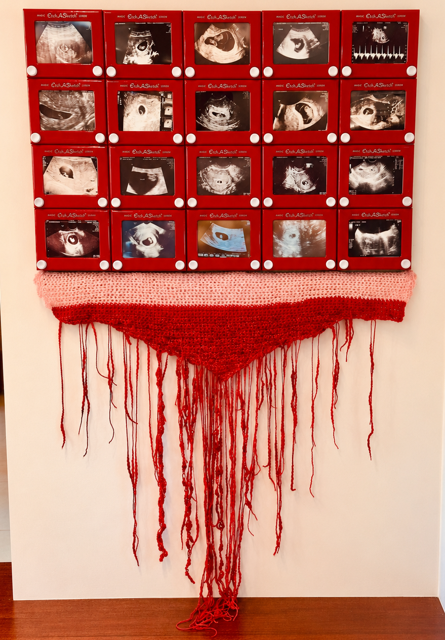 The Fragility of Early Pregnancy 2026. This piece contains ultrasound images generously donated by brave women whose pregnancies were lost to miscarriage. One day, you are dreamily knitting a baby blanket, nesting, making plans, then the blood comes 
