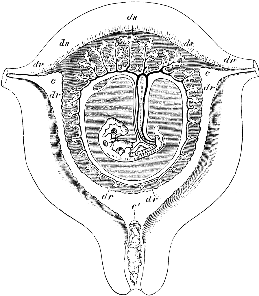 Pickles and Ice Cream