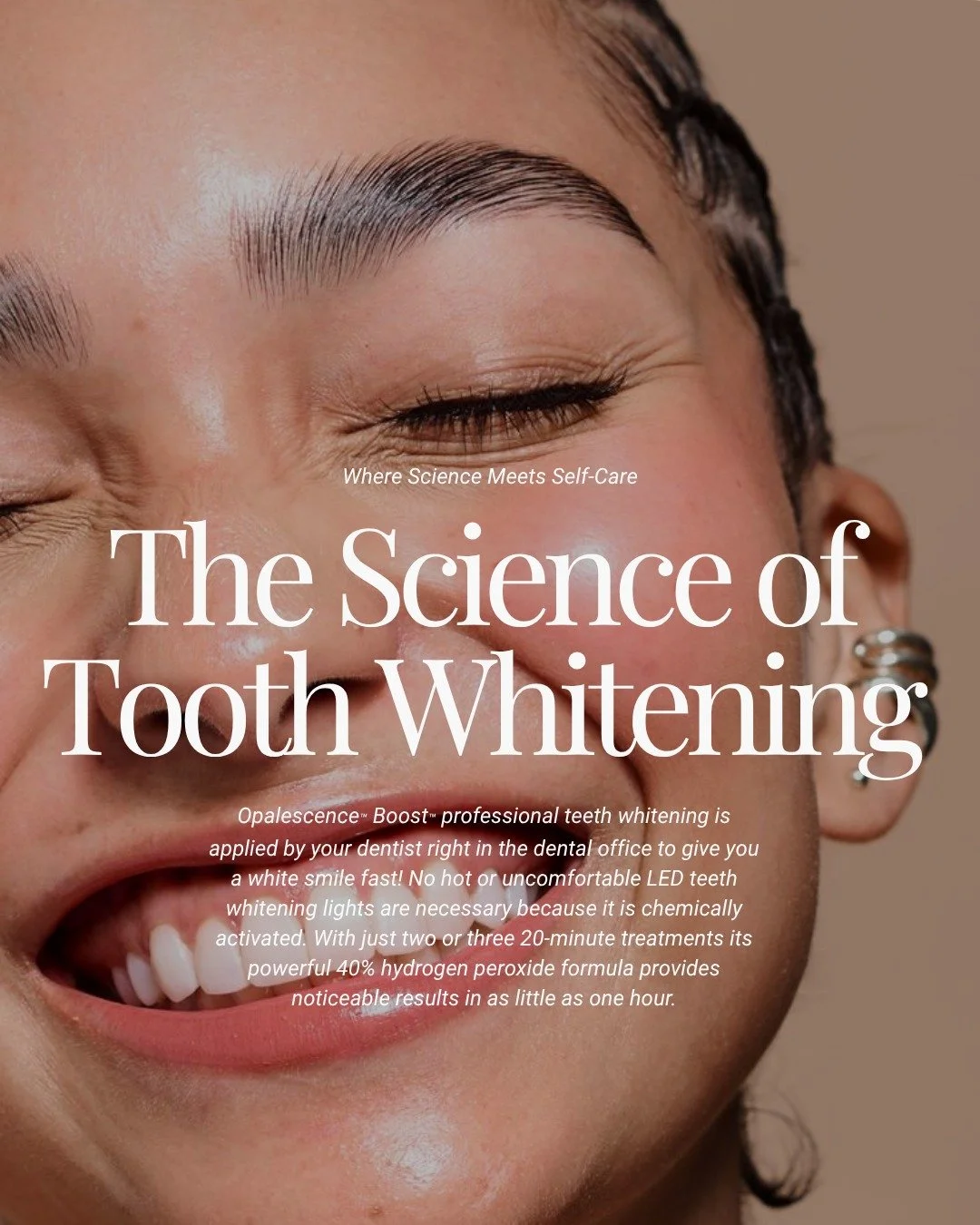Opalescence whitening gels contain a powerful whitening ingredient&mdash;either carbamide peroxide or hydrogen peroxide. Peroxide gels break down into water, oxygen, and reactive oxygen molecules. These reactive oxygen molecules oxidize the bonds of 