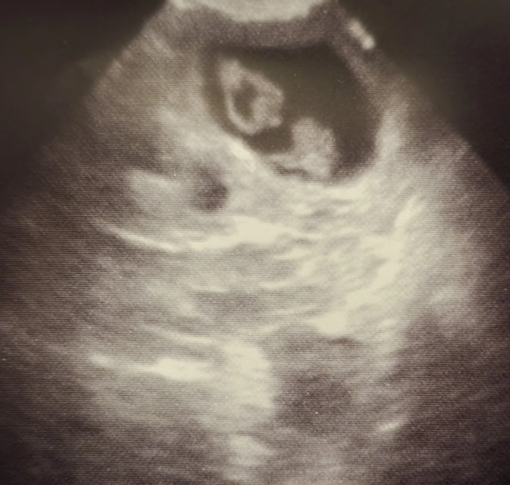 27.03.26 - Ultraschall