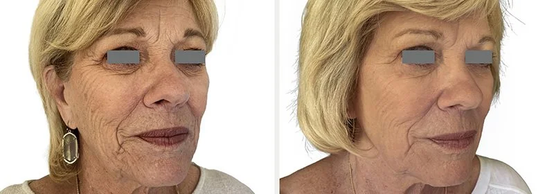 Side-by-side comparison of an older woman with makeup applied on the right and without makeup on the left.