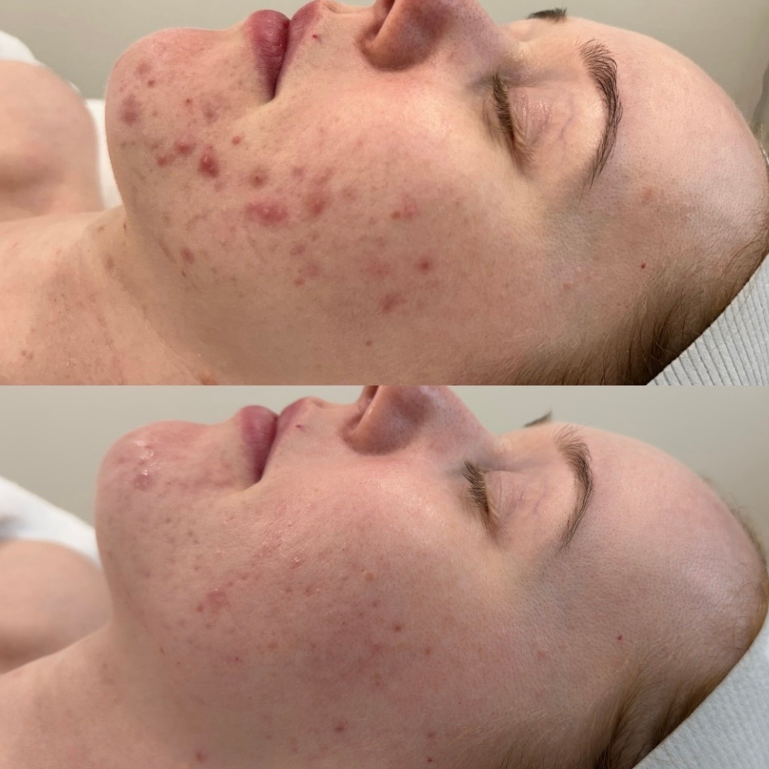 Before and Afters for web (2).png