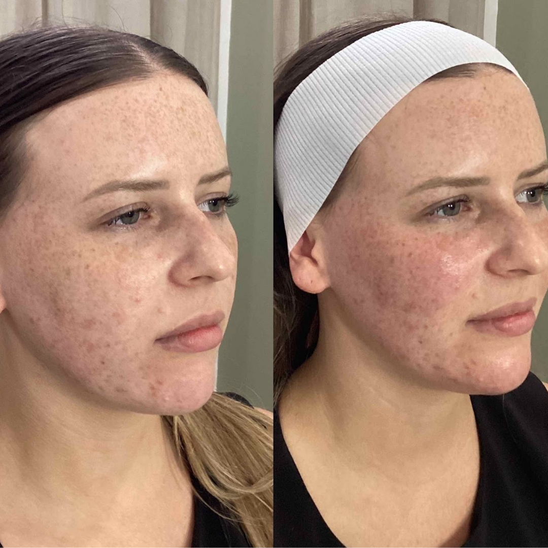 Before and Afters for web (4).png