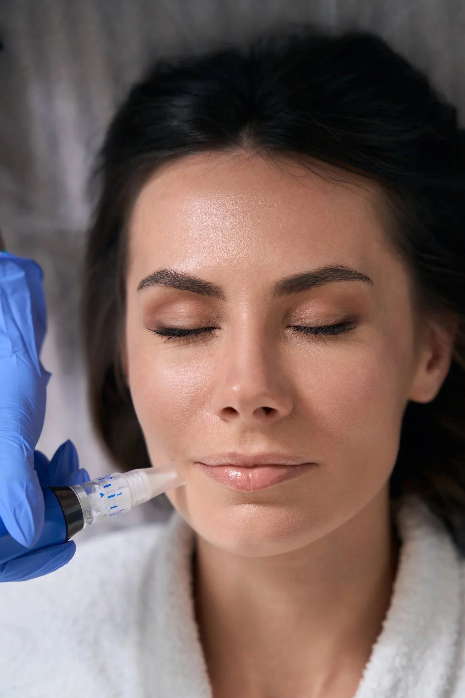Microneedling