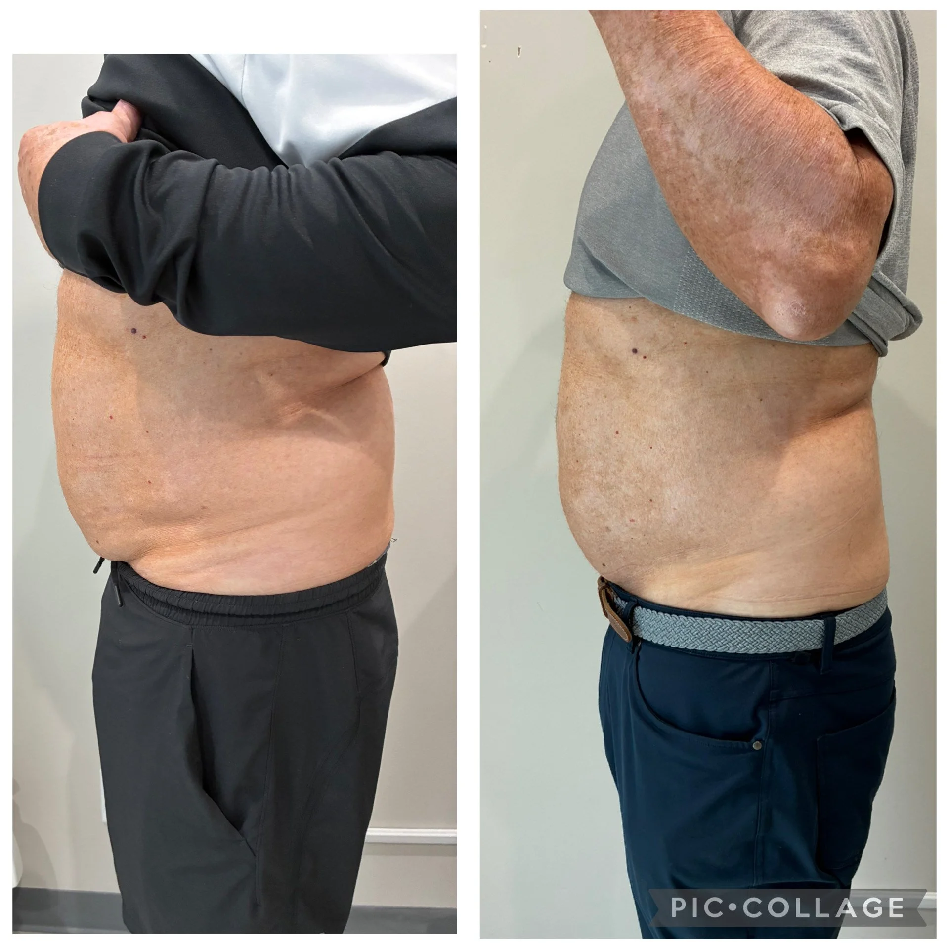 3 treatments side 2 (Mary Dugan - Aesthetics by Prescription).jpeg