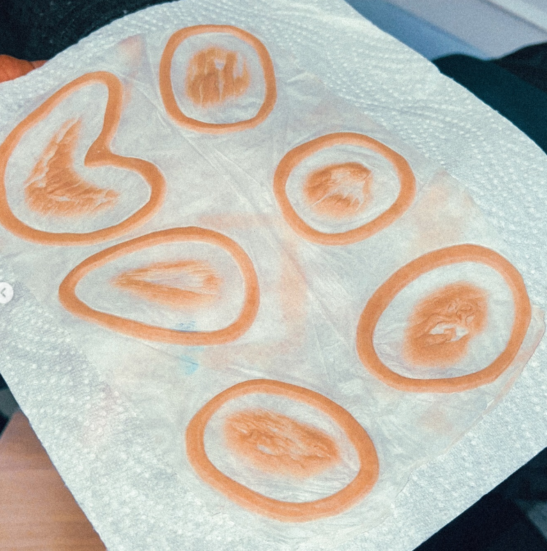 silicone prosthetics