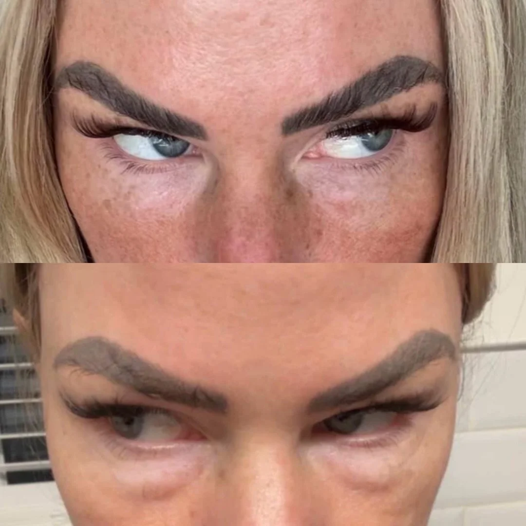 1 x Session of Derma Eyes👀

What is Derma Eyes 2.0?
Derma Eyes 2.0 is a targeted under-eye treatment formulated to help reduce puffiness, improve drainage, and enhance skin quality around the eyes. Ideal for clients concerned with tired, swollen-loo