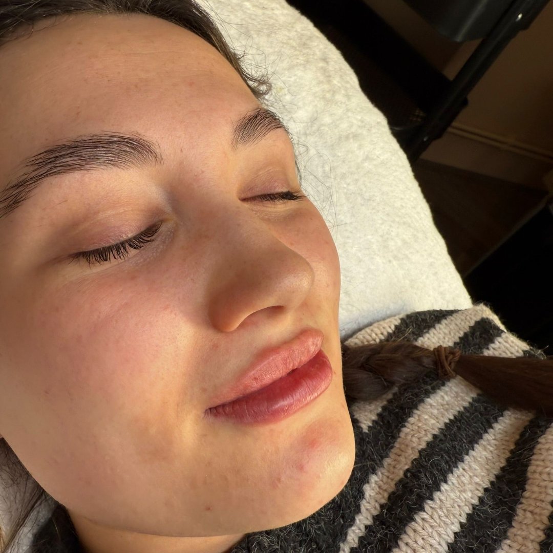 Close-up of smooth, healthy skin with refined results