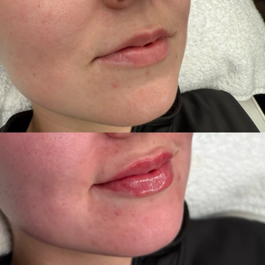 Clear, refreshed skin after professional facial