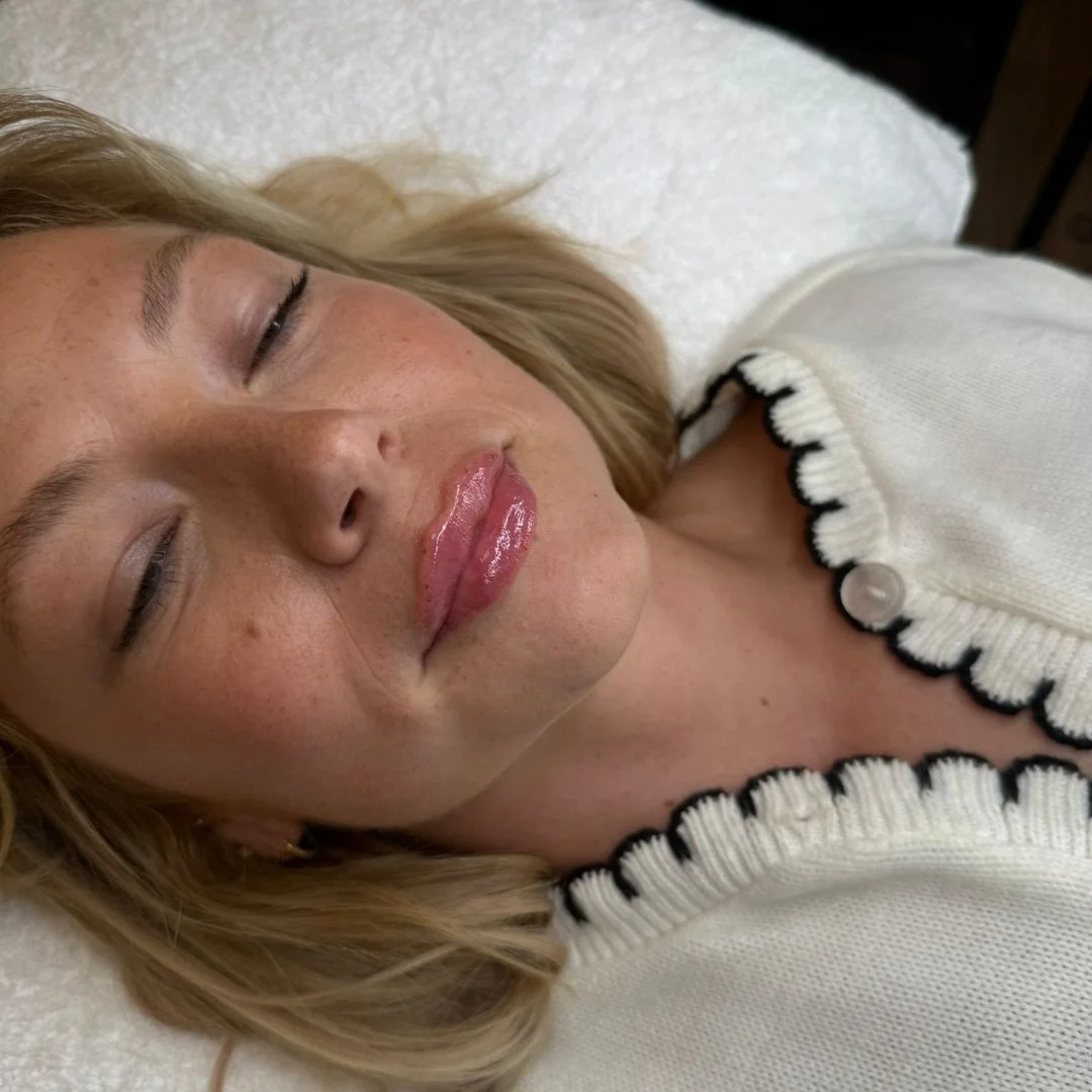 Subtle transformation with polished, natural aesthetic results