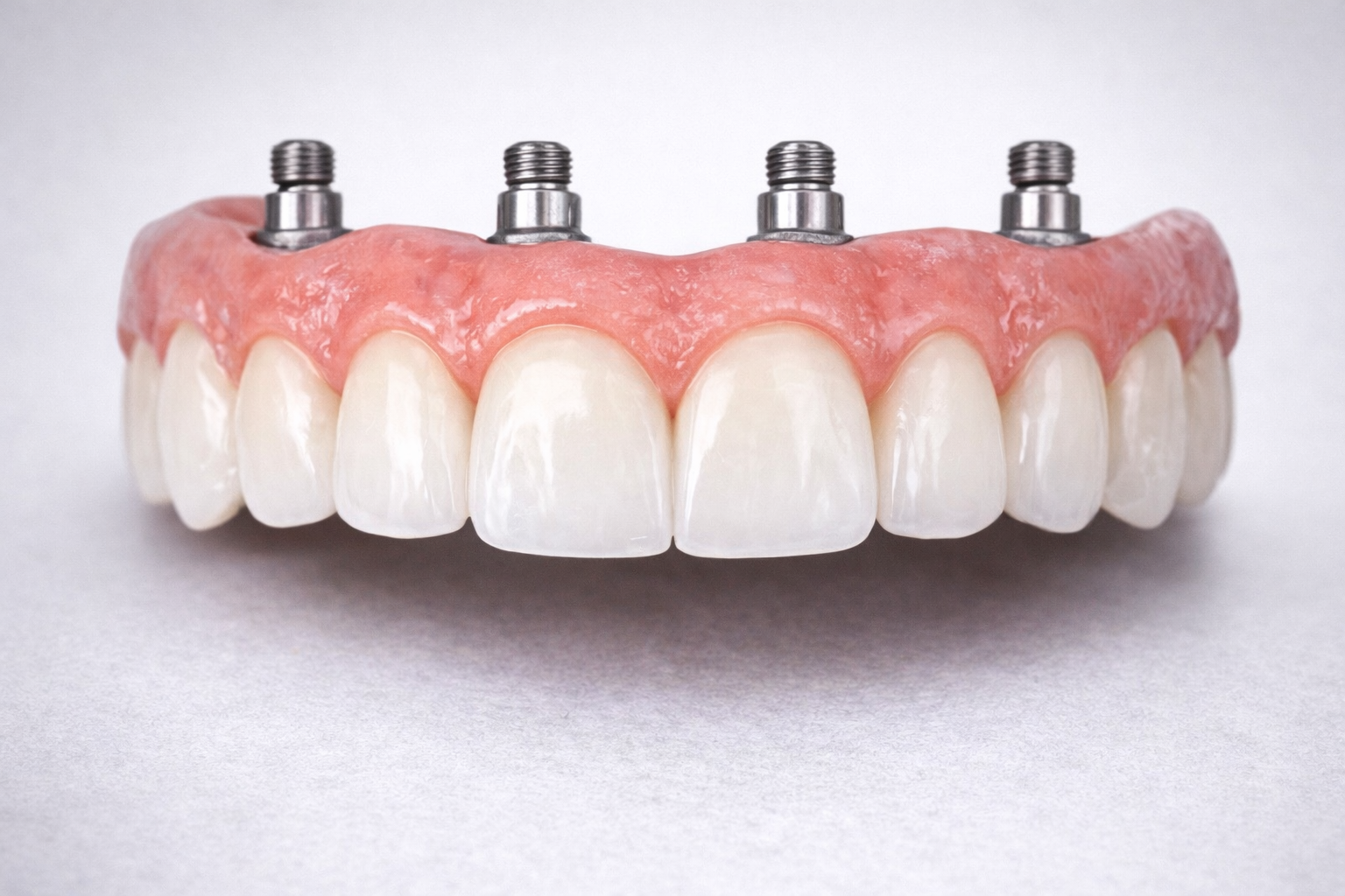 Dental implant model showing artificial teeth and metal posts.