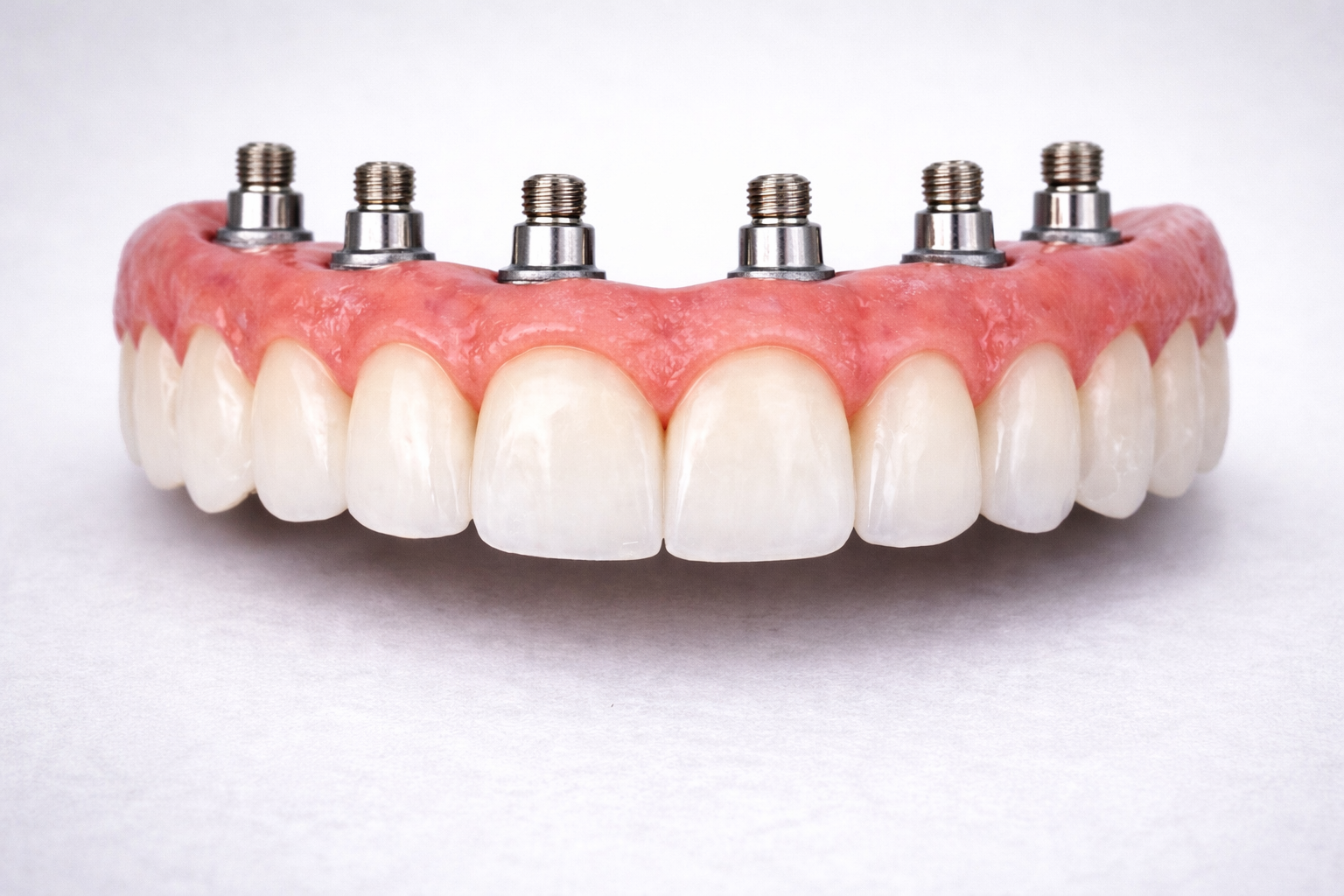 A set of artificial teeth with dental implants attached to a pink gum model.