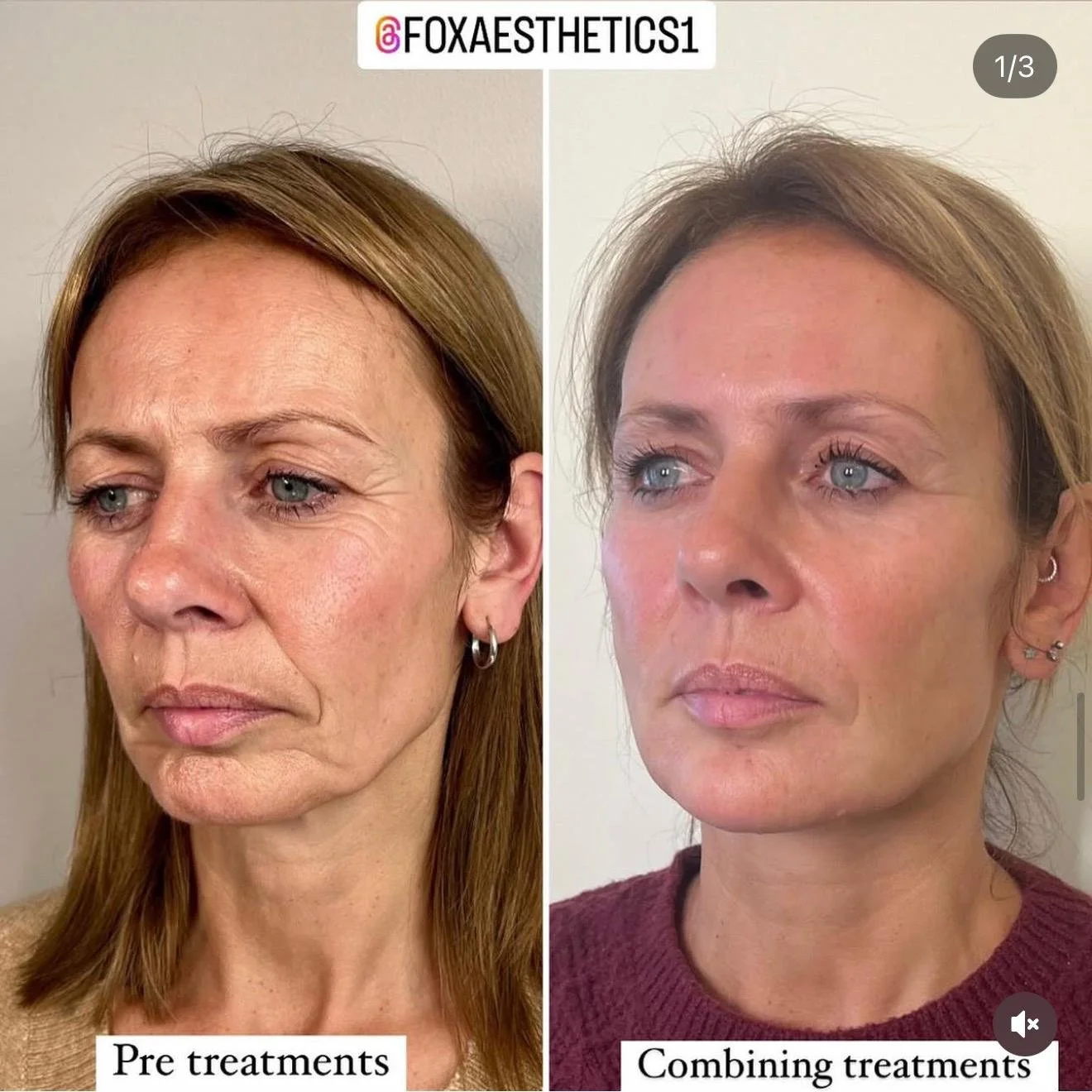 Medical-grade skincare treatment