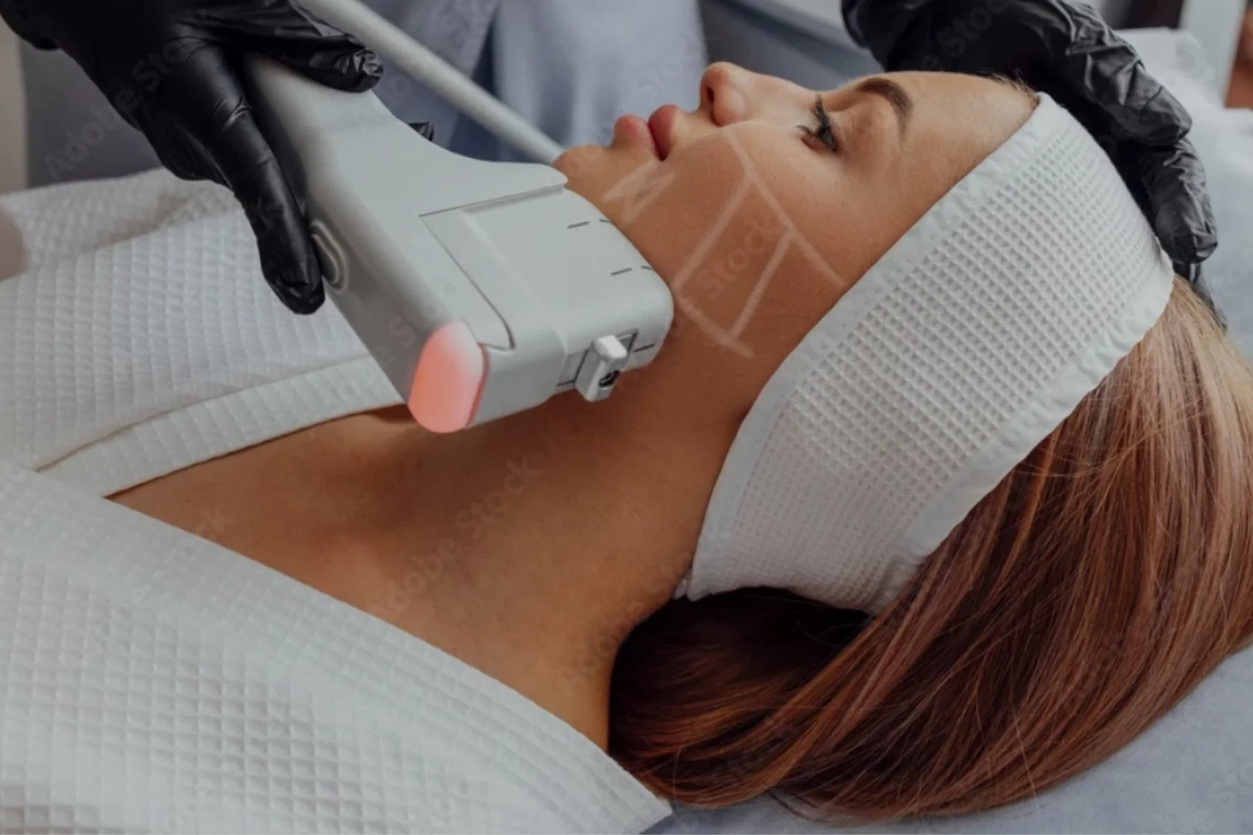 Dermal filler treatment consultation